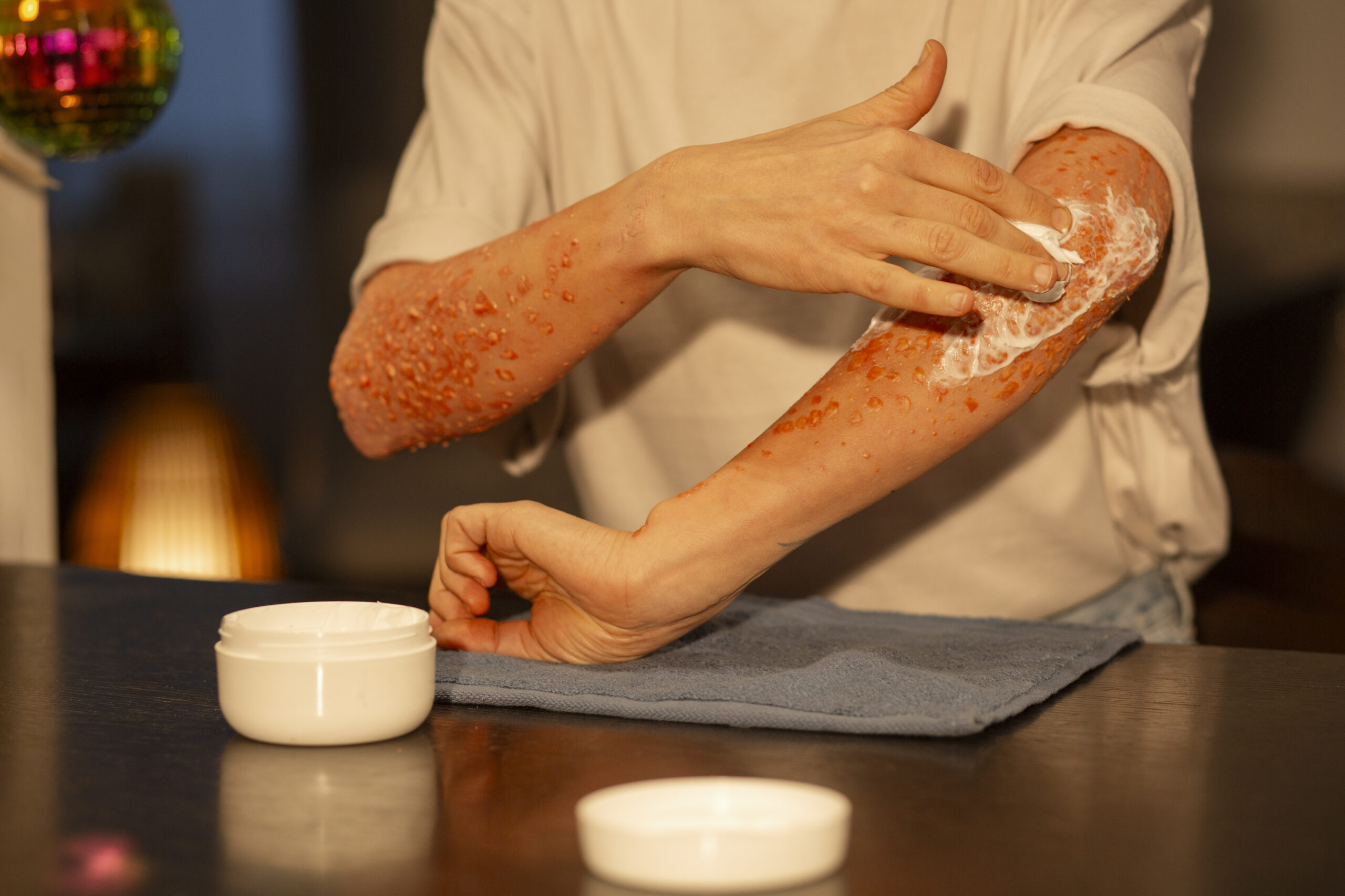 front-view-woman-experiencing-skin-disease