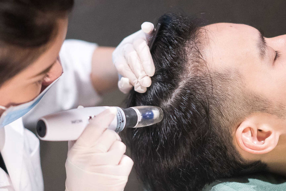 mesotherapy-for-hair-in-Pune