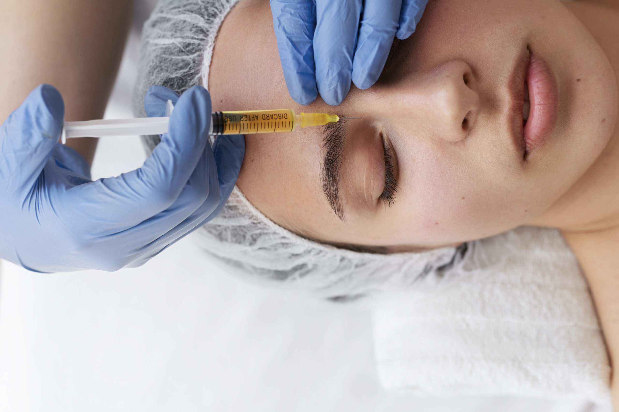 view-woman-getting-face-prp-treatment (1)