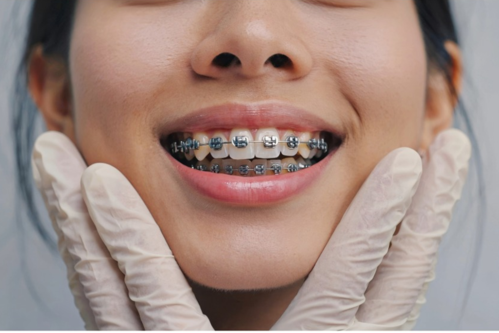 orthodontics